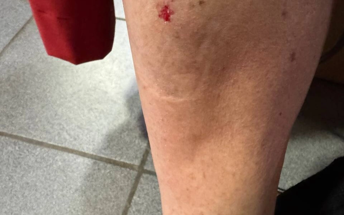 &laquo;Гематомы на голове&raquo;: еще одна пассажирка упала на скользком полу в &laquo;Яавтобусе&raquo;