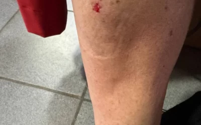 &laquo;Гематомы на голове&raquo;: еще одна пассажирка упала на скользком полу в &laquo;Яавтобусе&raquo;