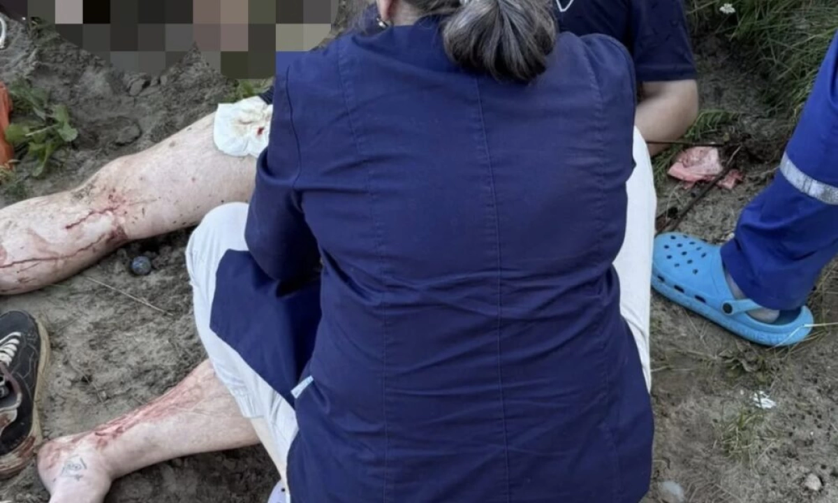 В Ярославле мужчина на пляже проколол ногу шампуром