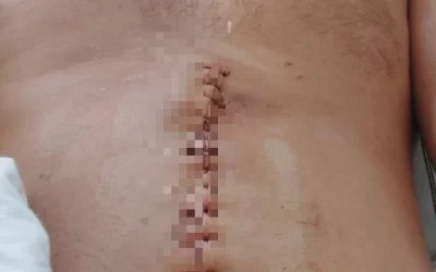 В Тутаеве активист пострадал в результате нападения с ножом